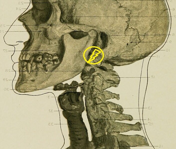 Crâne de profil cervicalgie