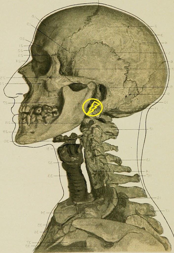 Crâne de profil cervicalgie
