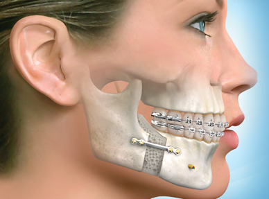 maxillo faciale osteopathe melun