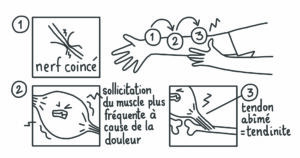 image1large Quelqu'un qui a eu la même chose que moi et qui a été soulagé 1 quelqu'un qui a eu la même chose que moi